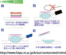 ESD figure